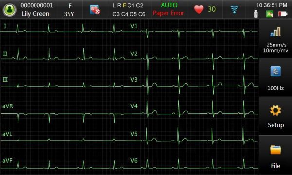 SE-301 Pantalla SE301 ECG Leex