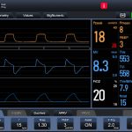 Leex V3 Ventilator