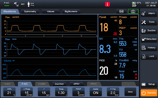 ventilador-leex-v3-10 Leex V3 Ventilator
