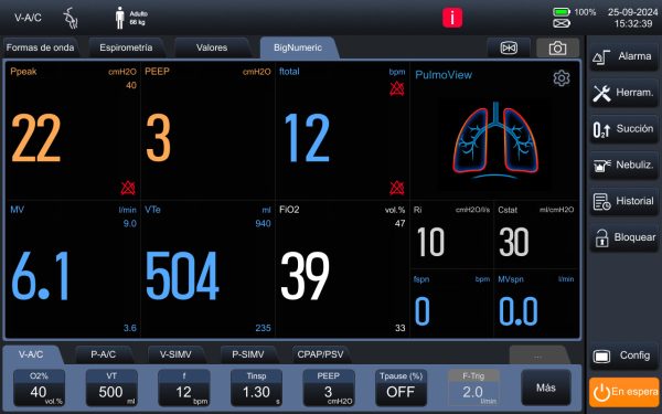 ventilador-leex-v3-7 Leex V3 Ventilator
